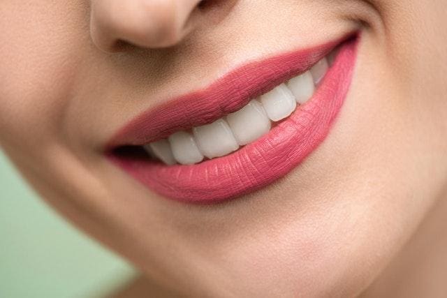 Close up of person smiling with flawless teeth after Zoom teeth whitening in Danvers