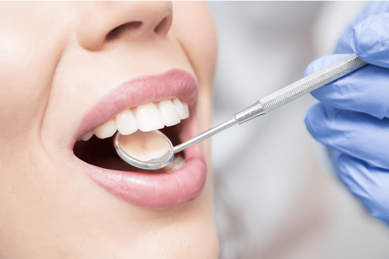 Why You Should Have Periodontal Maintenance