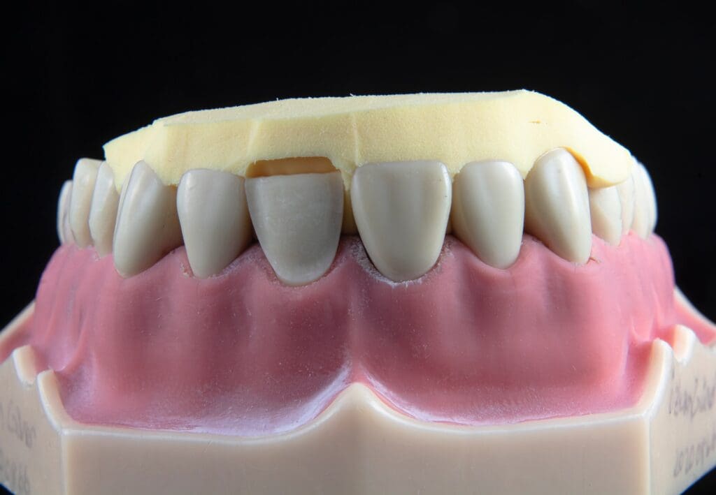 Dental model placed on a table