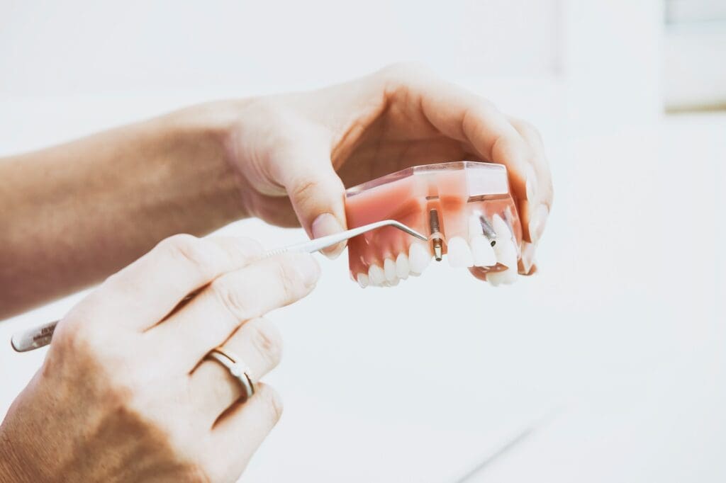 Model demonstrating dental bridge removal