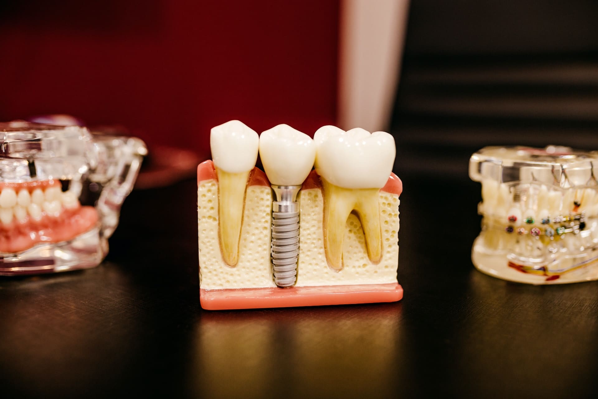 Dental implant model on table