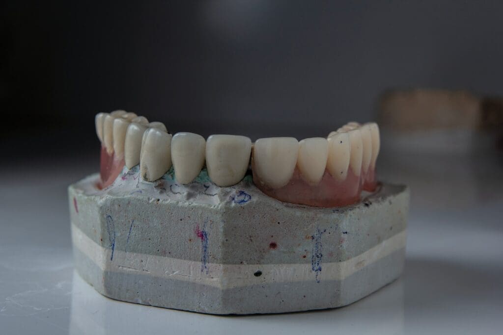 Model of dental veneers on a table