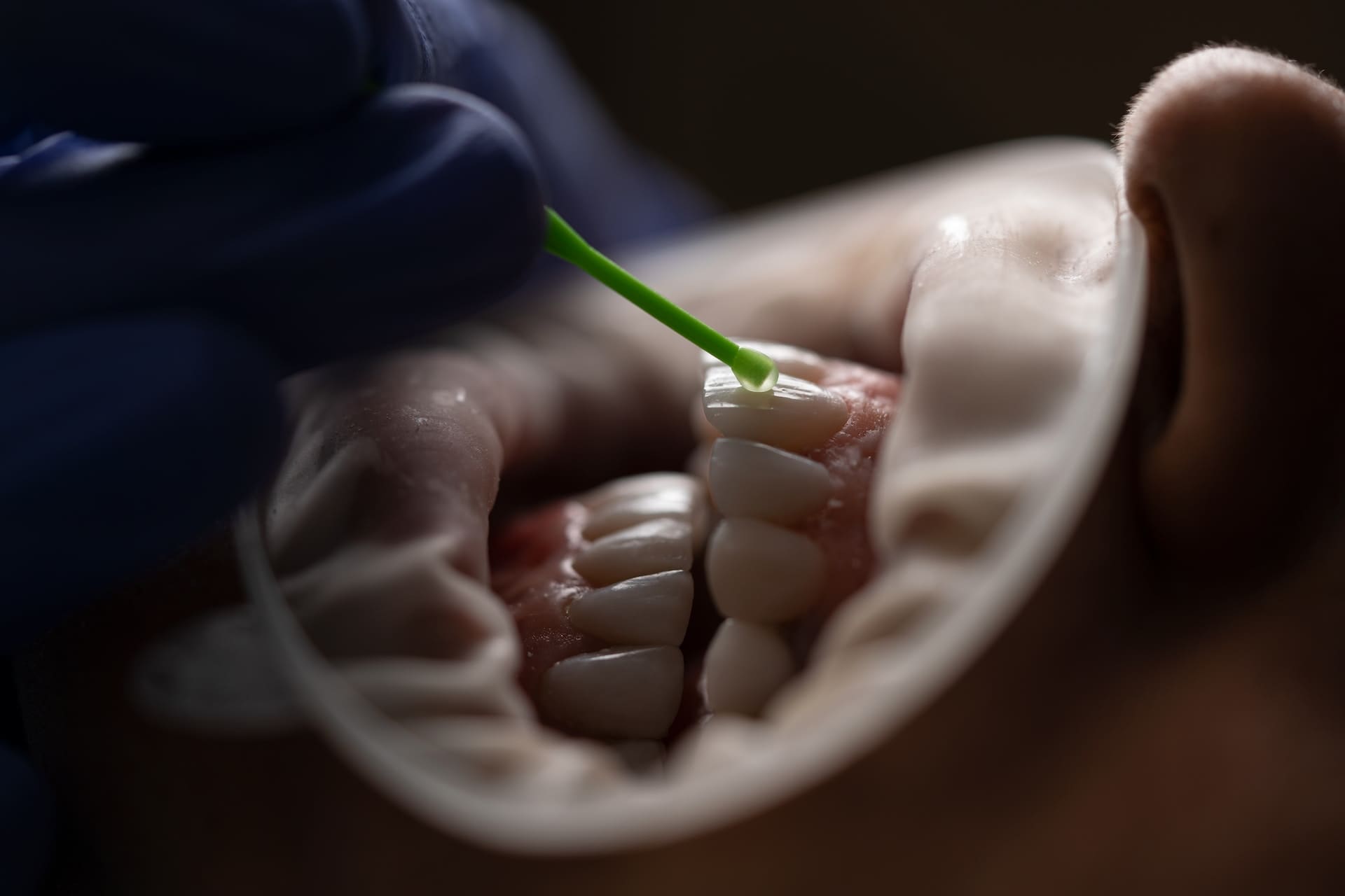 Close-up image of mouth with dentist examining.