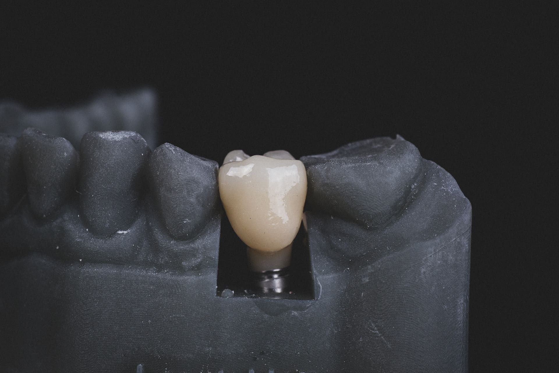 Dental implant tooth model