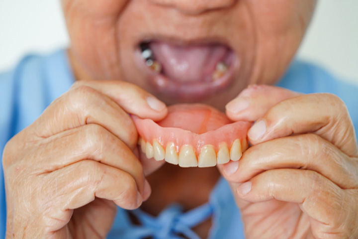 An open hand holding a removable denture.