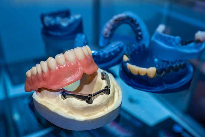 Dentures being crafted at lab.