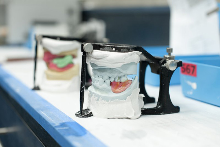 Dentures being crafted at lab.