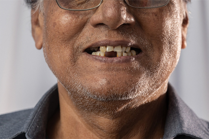 Up-close view of a man’s incomplete smile.