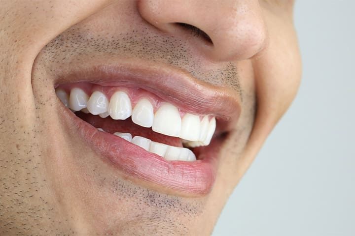 A close-up of whitened teeth.