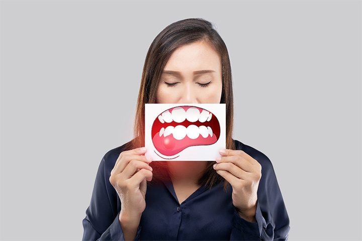 A woman holding an illustration of diseased gums in front of her mouth.