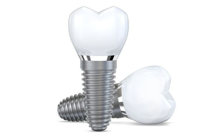 Render of two dental implants in Danvers, MA